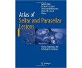 Atlas of Sellar and Parasellar Lesions 1st/2016